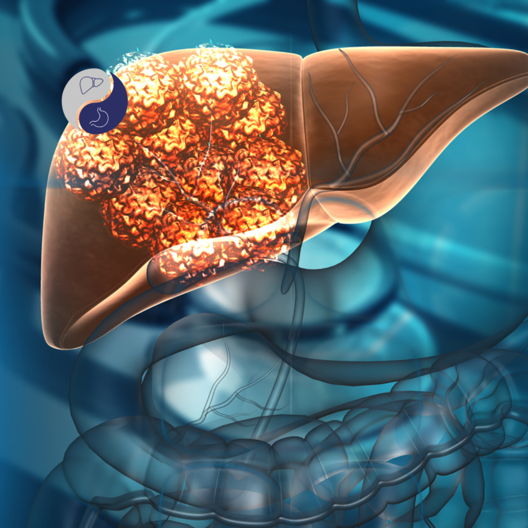 Tumor no Fígado